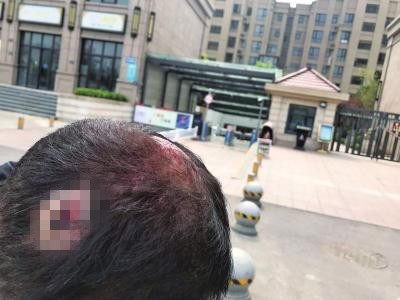 物业和业主因临时停车起冲突 业主：保安拿砖砸我